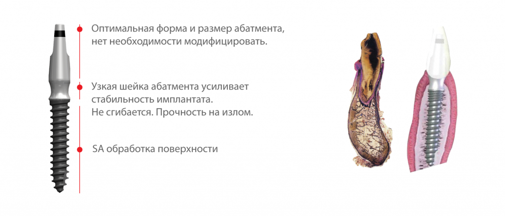 Имплантаты для узкого гребня