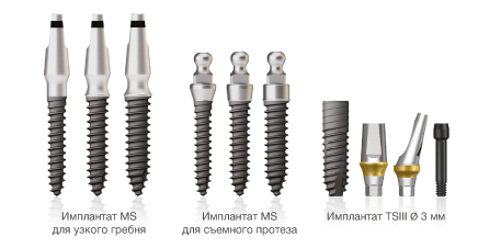 Имплантаты MS и TS III
