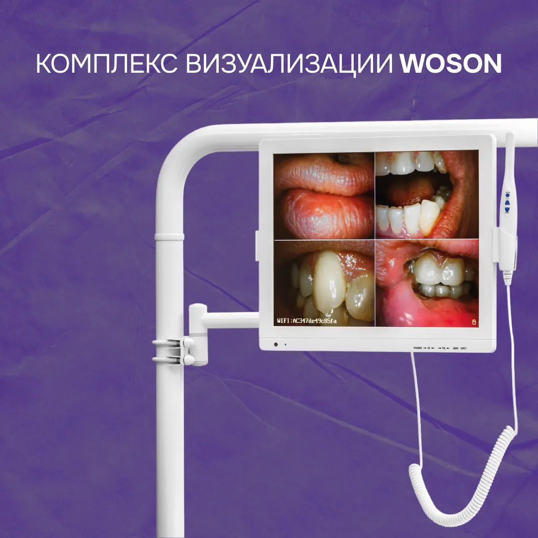 Комплекс визуализации WOSON