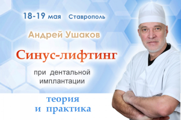 Синус-лифтинг при дентальной имплантации